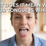 What Does It Mean When Your Tongue Is White